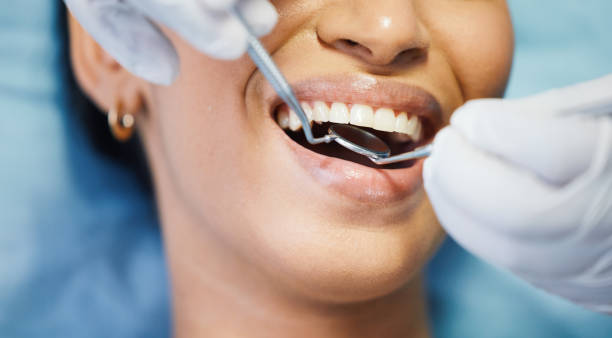 Best Emergency Dental Care for Abscessed Tooth in Tornillo, TX