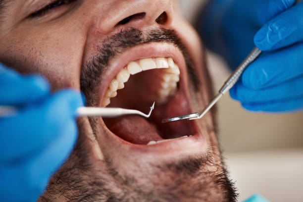 Best Emergency Dental Services for Seniors in Tornillo, TX